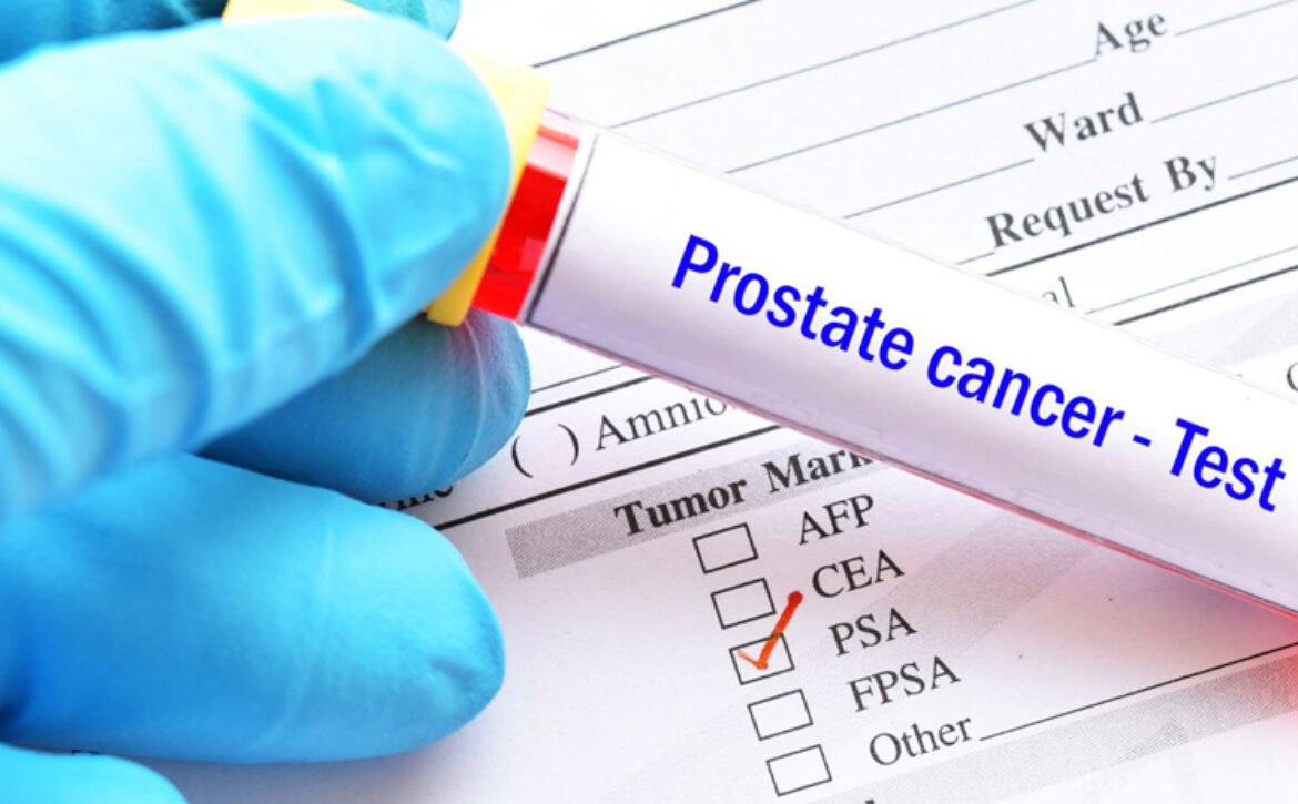 articulo_cancer-prostata