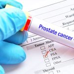 Una prueba para la detección temprana del cáncer de próstata