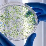 Hablemos de disbiosis intestinal